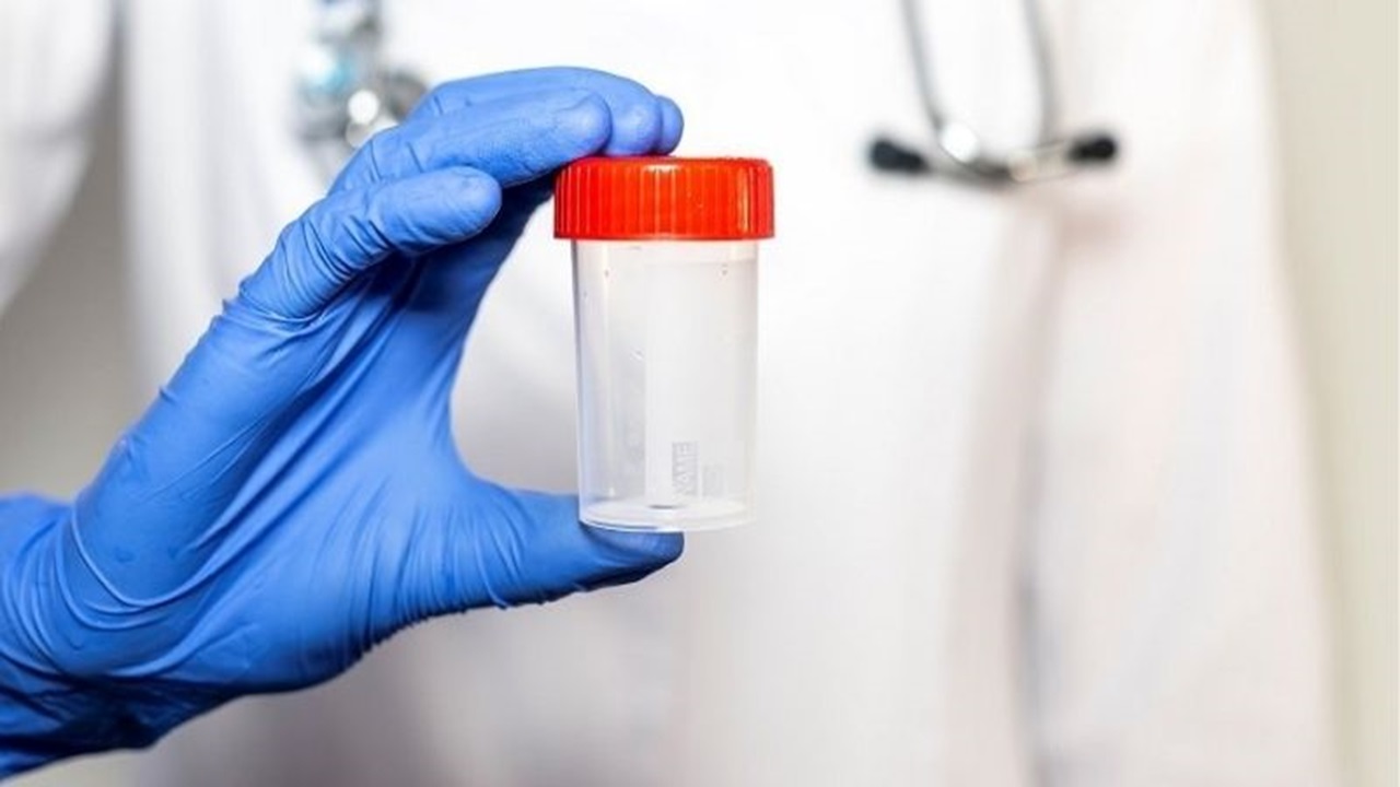 Sperm Testi ile Hastalık Teşhisleri Çok Kolay