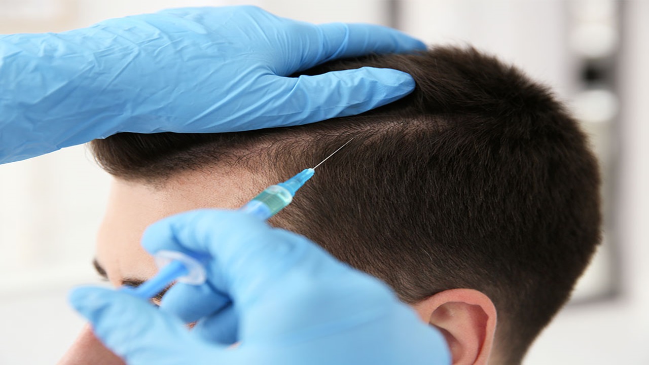 Ankara Saç Kök Hücre Tedavisi ile Sağlıklı Saçlara Sahip Olun